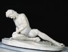 Dying Gaul (Roman copy); Dying Gallic Trumpeter; Dying Gaul