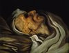 After Death; Study of a Head of a Corpse; Tete d'Homme Mort