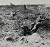 Death of a French soldier in Champagne, World War 1